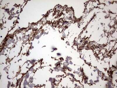 Immunohistochemistry: IL-1ra/IL-1F3/IL1RN Antibody (OTI2B1) - Azide and BSA Free [NBP2-71022]