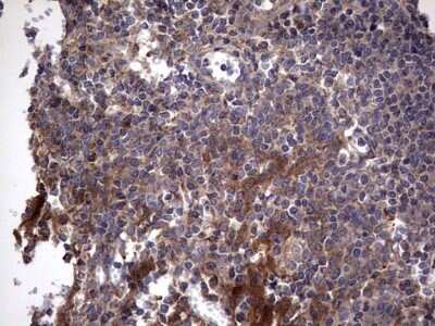 Immunohistochemistry: IL-1ra/IL-1F3/IL1RN Antibody (OTI2B1) - Azide and BSA Free [NBP2-71022]