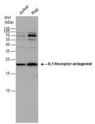 Western Blot: IL-1ra/IL-1F3/IL1RN Antibody [NBP1-32568]