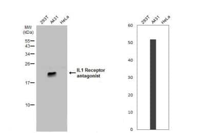 Western Blot: IL-1ra/IL-1F3/IL1RN Antibody [NBP1-32568]