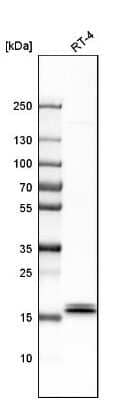 Western Blot: IL-1ra/IL-1F3/IL1RN Antibody [NBP1-81616]