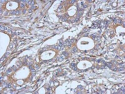 Immunohistochemistry-Paraffin: IL-2 Antibody [NBP2-16948]