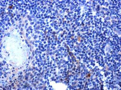 Immunohistochemistry-Paraffin: IL-2 Antibody [NBP2-16948]