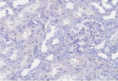 Immunohistochemistry-Paraffin: IL-2 R beta Antibody [NBP2-34148]