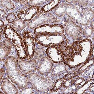 Immunohistochemistry: IL-20R alpha Antibody [NBP1-89633]