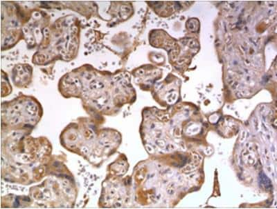 Immunohistochemistry-Paraffin: IL-20R alpha Antibody (MM0394-9F40) - Azide and BSA Free [NBP2-11695]