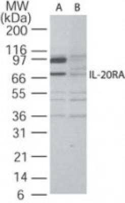 Western Blot: IL-20R alpha Antibody [NB100-56409]