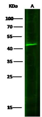 Western Blot: IL-20 R beta/FNDC6 Antibody [NBP2-98428]