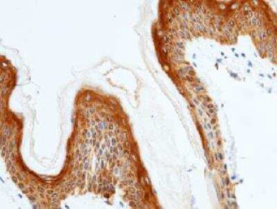 Immunohistochemistry-Paraffin: IL-20R alpha Antibody (024) [NBP2-89468]