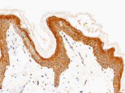 Immunohistochemistry-Paraffin: IL-20R alpha Antibody (038) [NBP2-89469]