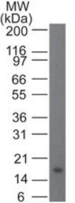 Western Blot: IL-21 Antibody (14k5H3) [NBP2-27336]