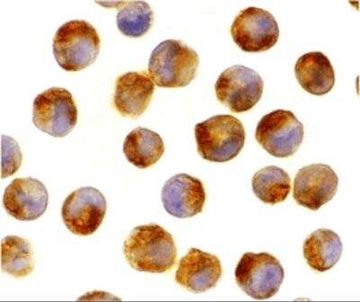 Immunocytochemistry/ Immunofluorescence: IL-21 Antibody - BSA Free [NBP1-76740]