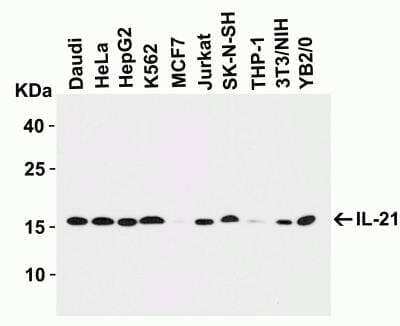 Western Blot: IL-21 AntibodyBSA Free [NBP1-76740]