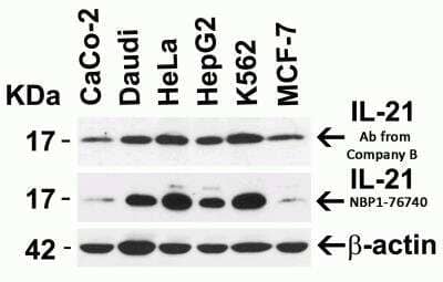 Western Blot: IL-21 AntibodyBSA Free [NBP1-76740]