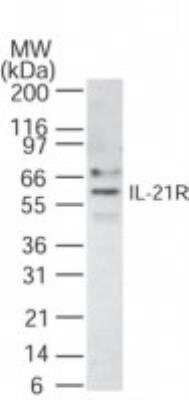 Western Blot: IL-21R Antibody [NB100-56439]