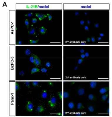 Immunocytochemistry/ Immunofluorescence: IL-21R Antibody - BSA Free [NBP1-76739]