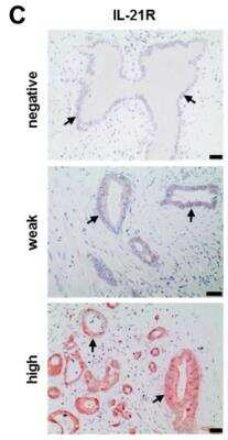 Immunohistochemistry: IL-21R Antibody - BSA Free [NBP1-76739]