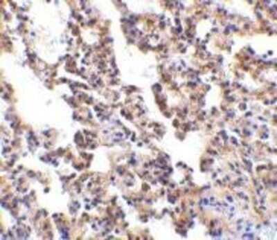Immunohistochemistry-Paraffin: IL-21R Antibody - BSA Free [NBP1-76739]