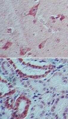Immunohistochemistry: IL-22 Antibody (8F11E2) - Azide and BSA Free [NBP2-80805]