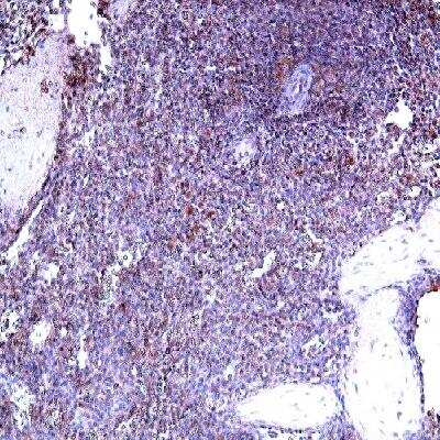 Immunohistochemistry-Paraffin: IL-22BP/IL22 RA2 Antibody - BSA Free [NB100-742]