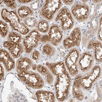 Immunohistochemistry-Paraffin: IL-22BP/IL22 RA2 Antibody [NBP1-85455]