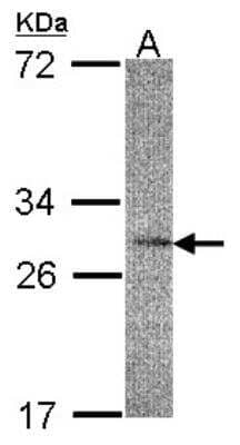 Western Blot: IL-22BP/IL22 RA2 Antibody [NBP1-32246]