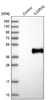 Western Blot: IL-22BP/IL22 RA2 Antibody [NBP1-85455]