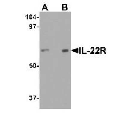 Western Blot: IL-22R alpha 1 AntibodyBSA Free [NBP1-76724]