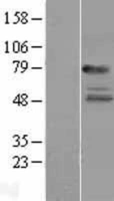 Western Blot: IL-22R alpha 1 Overexpression Lysate [NBL1-11941]