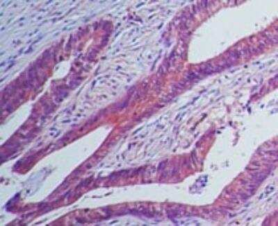 Immunohistochemistry-Paraffin: IL-23R Antibody (15N6C6) [NBP2-27091]