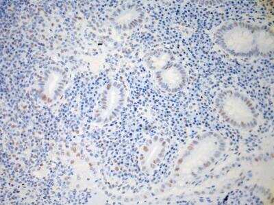 Immunohistochemistry-Paraffin: IL-23R Antibody (15N6C6) [NBP2-27091]