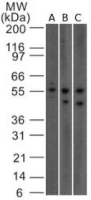 Western Blot: IL-23R Antibody (15N6C6) [NBP2-27091]