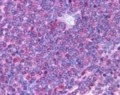 Immunohistochemistry-Paraffin: IL-23R Antibody [NB600-1147]