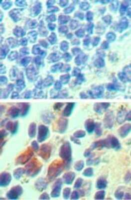 Immunohistochemistry-Paraffin: IL-23R Antibody [NB600-1147]