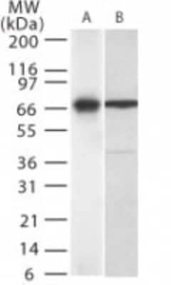 Western Blot: IL-23R Antibody [NB600-1147]