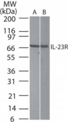 Western Blot: IL-23R Antibody [NB600-1147]