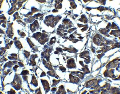Immunohistochemistry: IL-23A/IL-23 P19 Antibody - BSA Free [NBP1-77257]