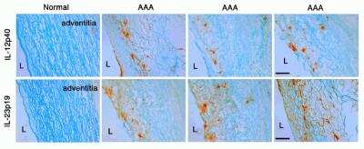 Immunohistochemistry-Paraffin: IL-23A/IL-23 P19 Antibody - BSA Free [NBP1-77257]