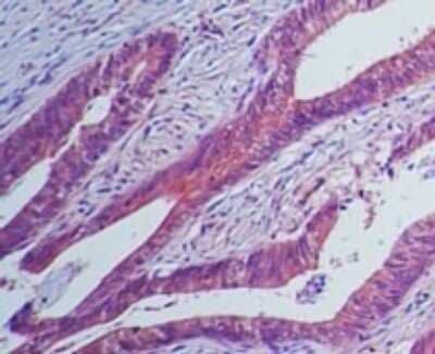Immunohistochemistry-Paraffin: IL-23R Antibody (15N6C6) - Azide Free [NBP2-27092]