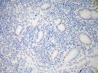 Immunohistochemistry-Paraffin: IL-23R Antibody (15N6C6) - Azide Free [NBP2-27092]