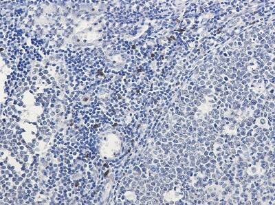 Immunohistochemistry-Paraffin: IL-26/AK155 Antibody (S07-3C0) [NBP3-19879]