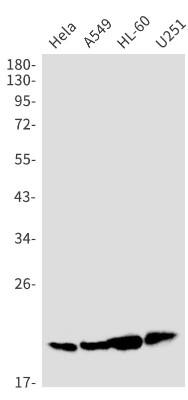 Western Blot: IL-26/AK155 Antibody (S07-3C0) [NBP3-19879]