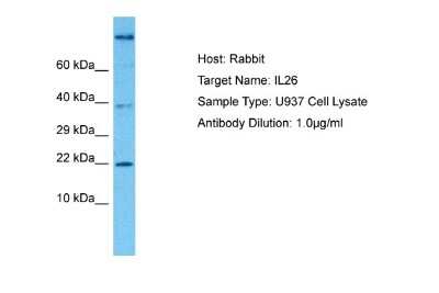 Western Blot: IL-26/AK155 Antibody [NBP1-98520]