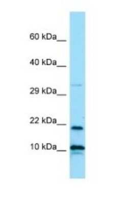 Western Blot: IL-26/AK155 Antibody [NBP1-98521]