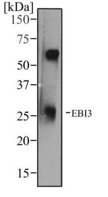 Western Blot: EBI3 Antibody (10J803) [NBP2-03940]