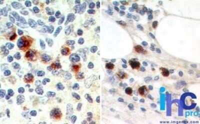 Immunohistochemistry-Paraffin: EBI3 Antibody (15k8D10) - Azide Free [NBP2-27363]
