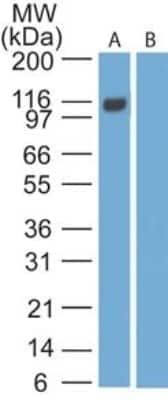 Western Blot: EBI3 Antibody (15k8D10)Azide Free [NBP2-27363]