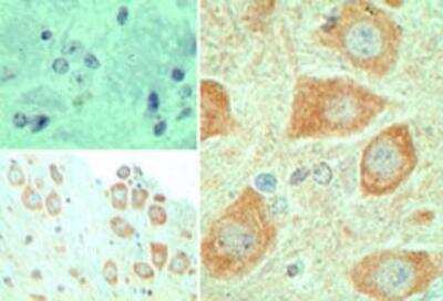 Immunohistochemistry-Paraffin: EBI3 Antibody - BSA Free [NBP2-03944]