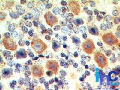Immunohistochemistry-Paraffin: EBI3 Antibody - BSA Free [NBP2-03944]