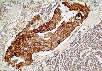 Immunohistochemistry-Paraffin: IL-27R alpha/WSX-1/TCCR Antibody (34N4G11) - BSA Free [NBP2-19015]
